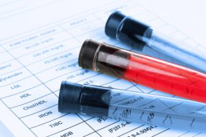 Blood in test tubes and results close up